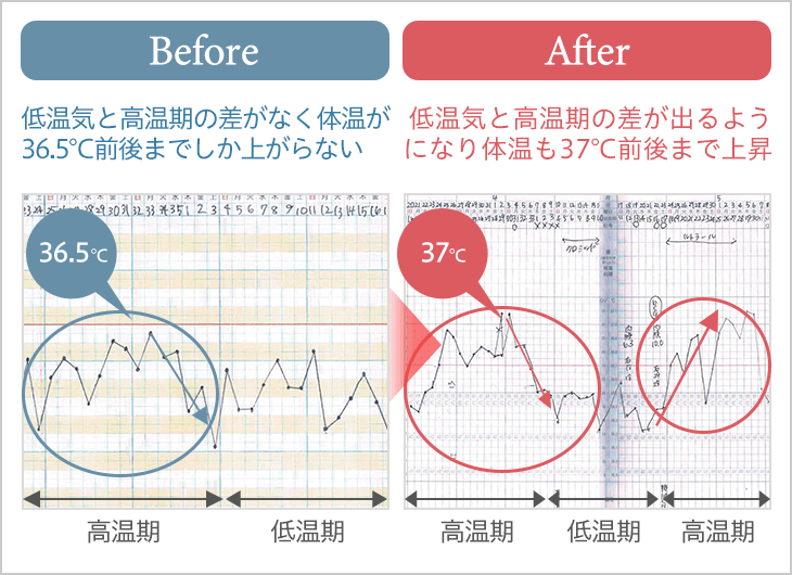 鍼灸で基礎体温が上がったBefore After