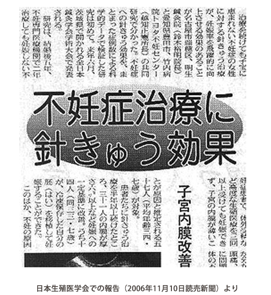 不妊症治療に針きゅう効果がある新聞記事